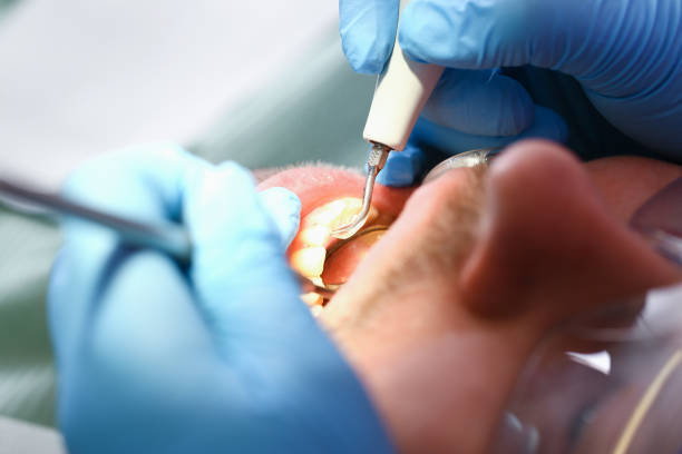 Best Emergency Treatment for Jaw Pain or Injury in Yorkshire, VA